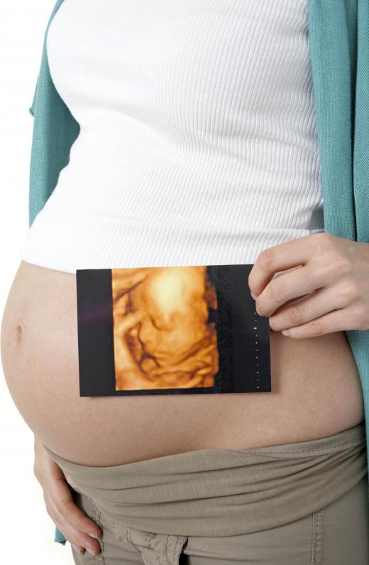 The use of cradle to grave may indicate the assessment and monitoring of someone from birth to death.